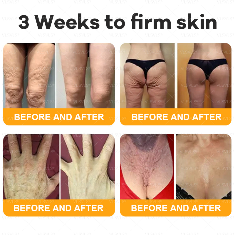 美🗽🗽🗽🌟Made and Shipped from USA ✨ VLSVLS® Bee Venom Skin Restoration Cream 🔥 LAST DAY 80% OFF