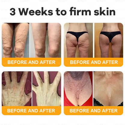 美🗽🗽🗽🌟Made and Shipped from USA ✨ VLSVLS® Bee Venom Skin Restoration Cream 🔥 LAST DAY 80% OFF